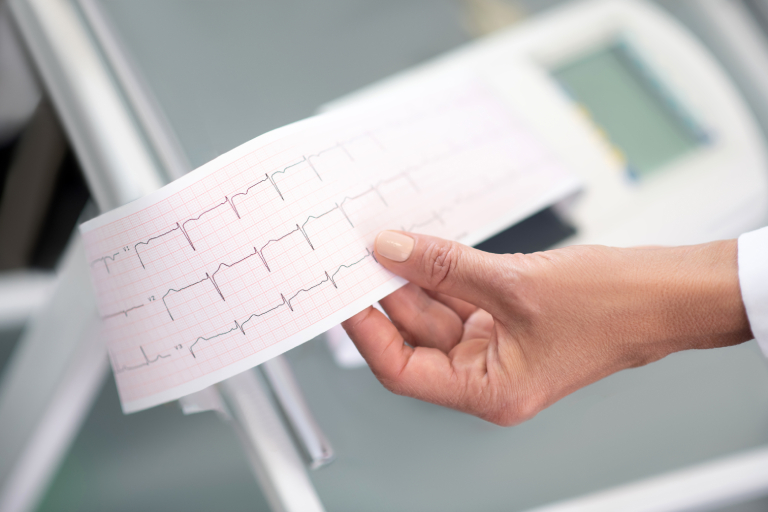 Frecuencia cardíaca | ¿Qué es y cuándo es normal?